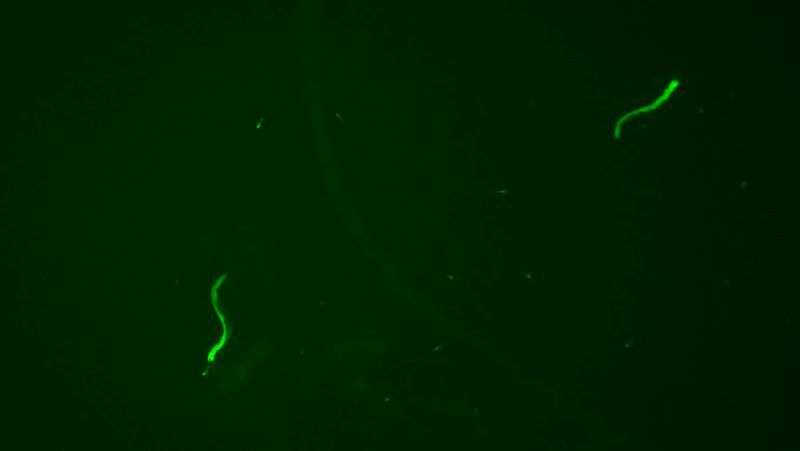 綠色熒光蛋白（GFP）在C elegans上的表達(dá)